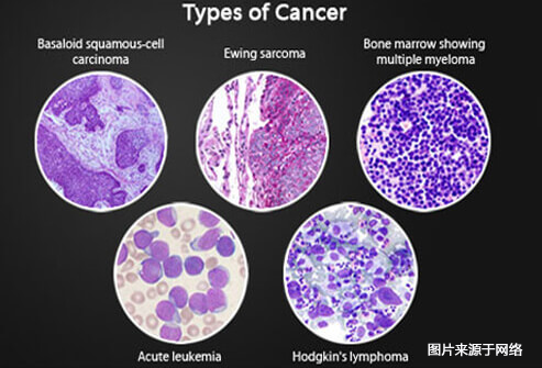 15张图带你深度了解癌症